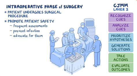 截刀臥位|Intraoperative care